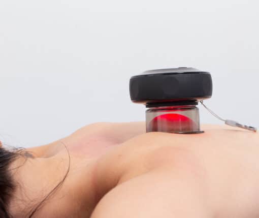 revivecup cupping therapy massager